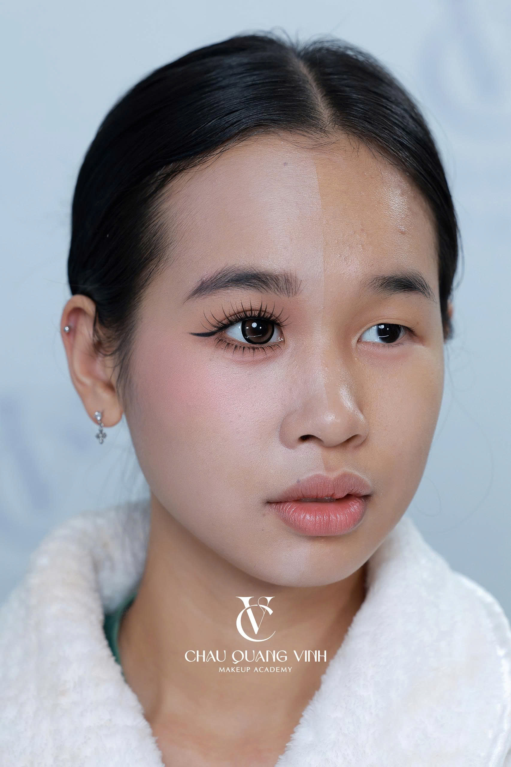 Before after mắt