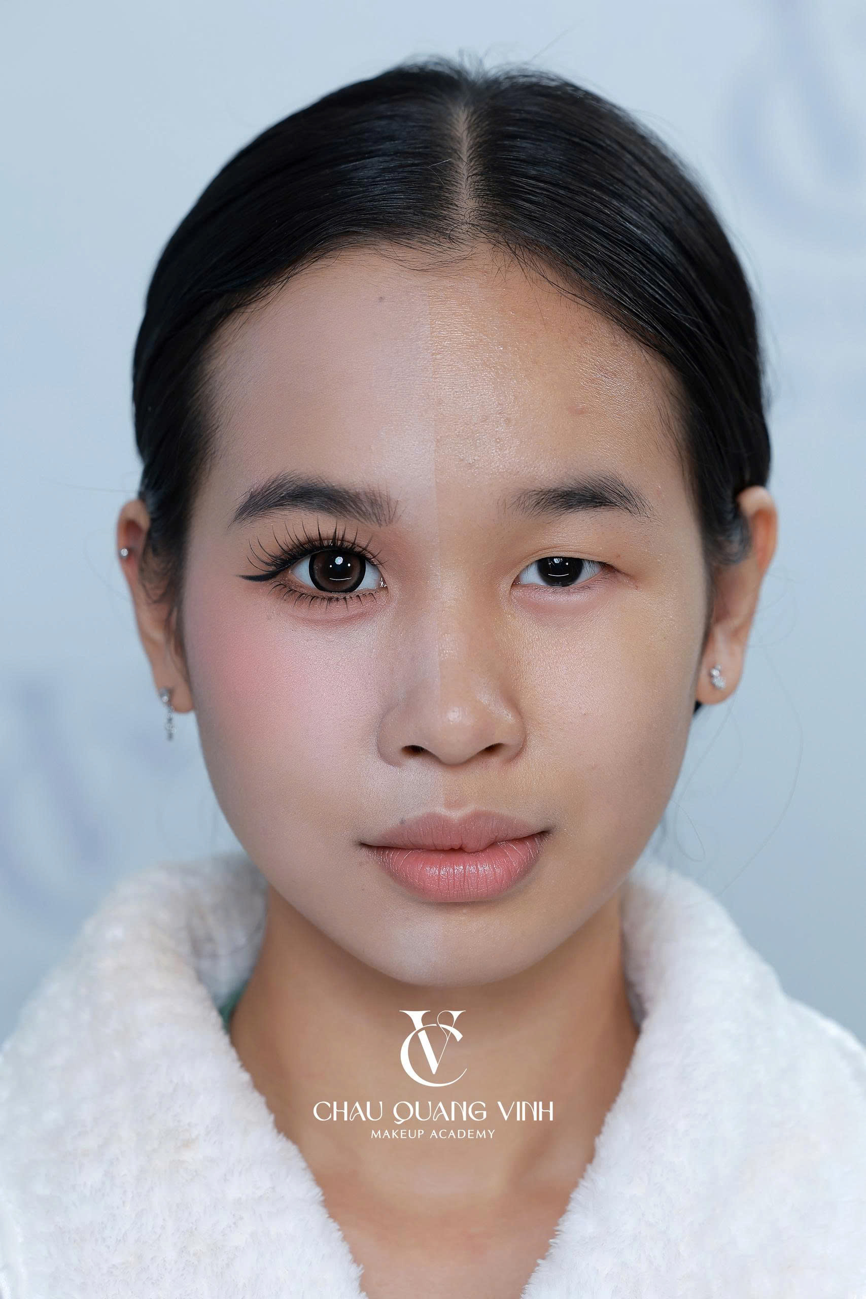Before after mắt