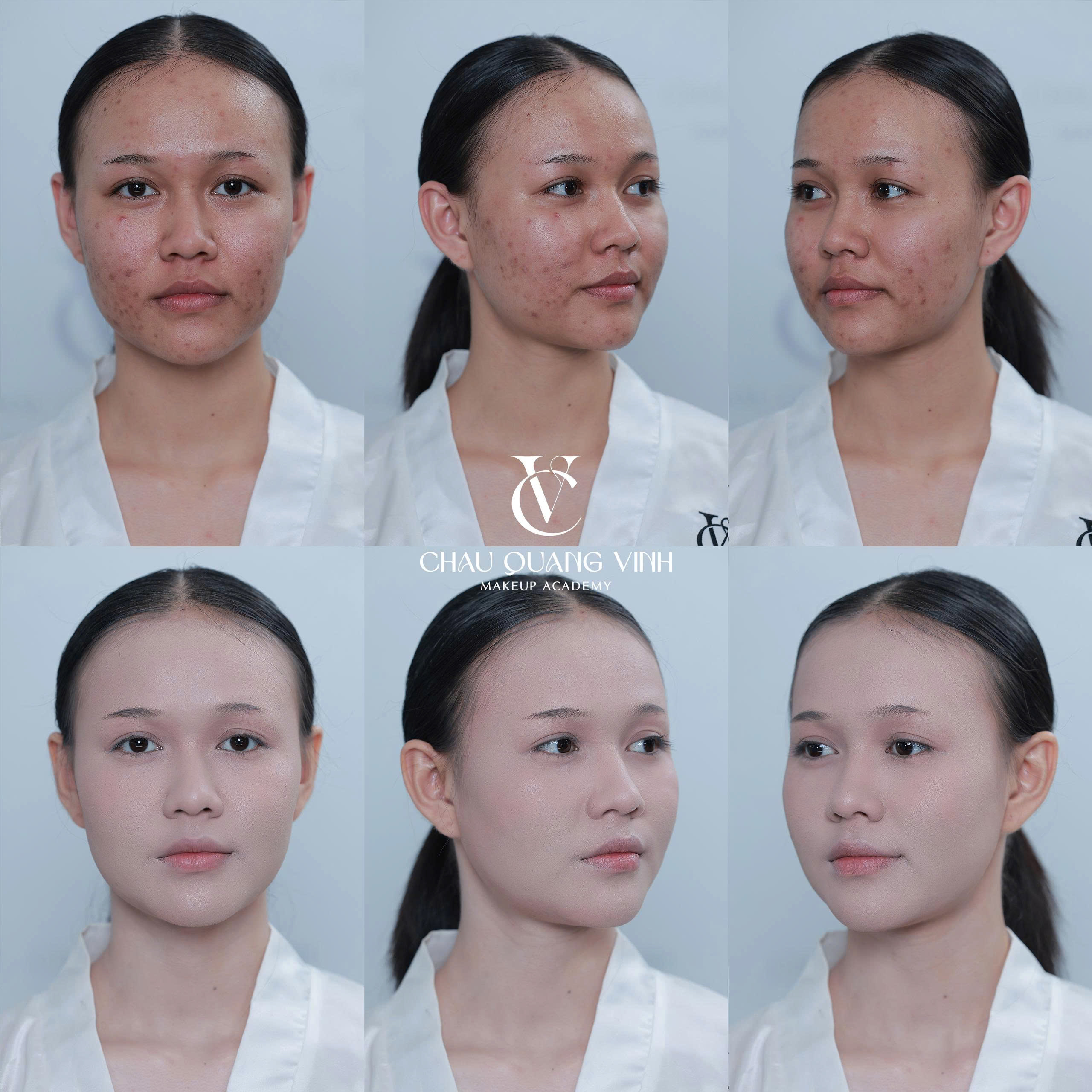 Before after nền